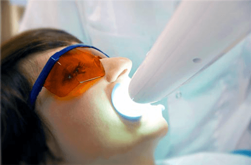 Understanding the Causes of Teeth Sensitivity Aylesbury