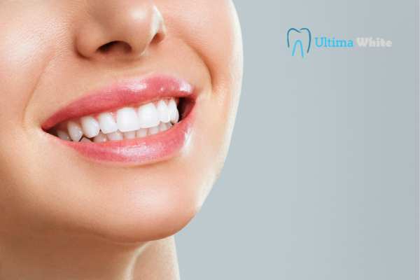 Common Mistakes That Can Ruin Your Whitening Results Aylesbury