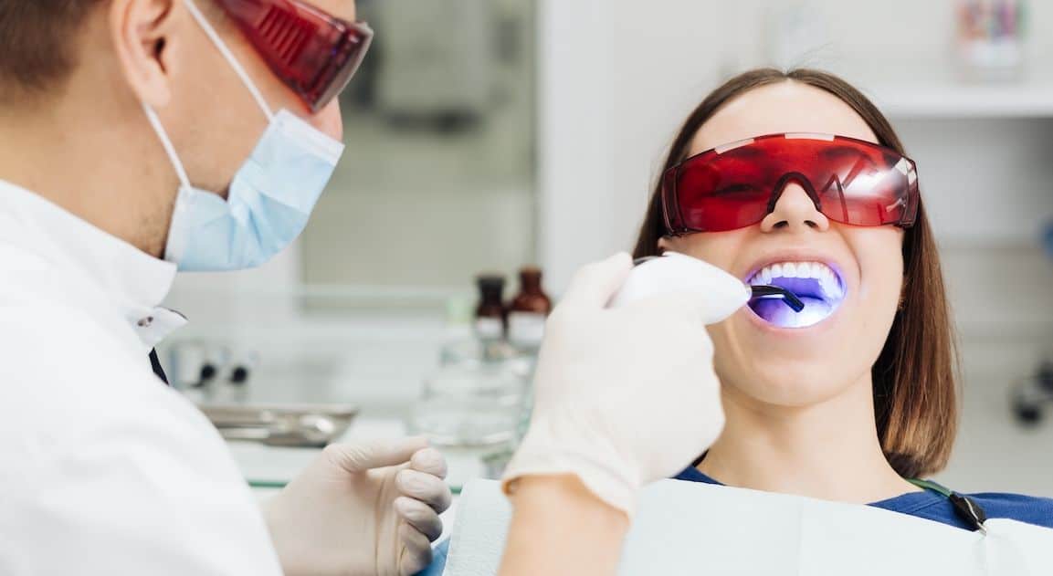 Do Dental Crowns Change Colour After Teeth Whitening Aylesbury?