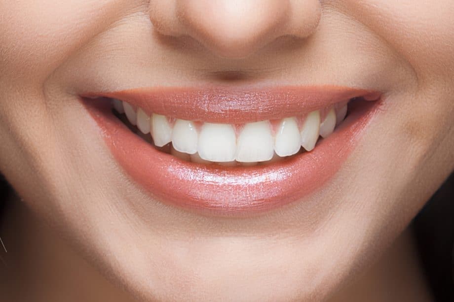 The Impact of White Spots on Oral Health Aylesbury