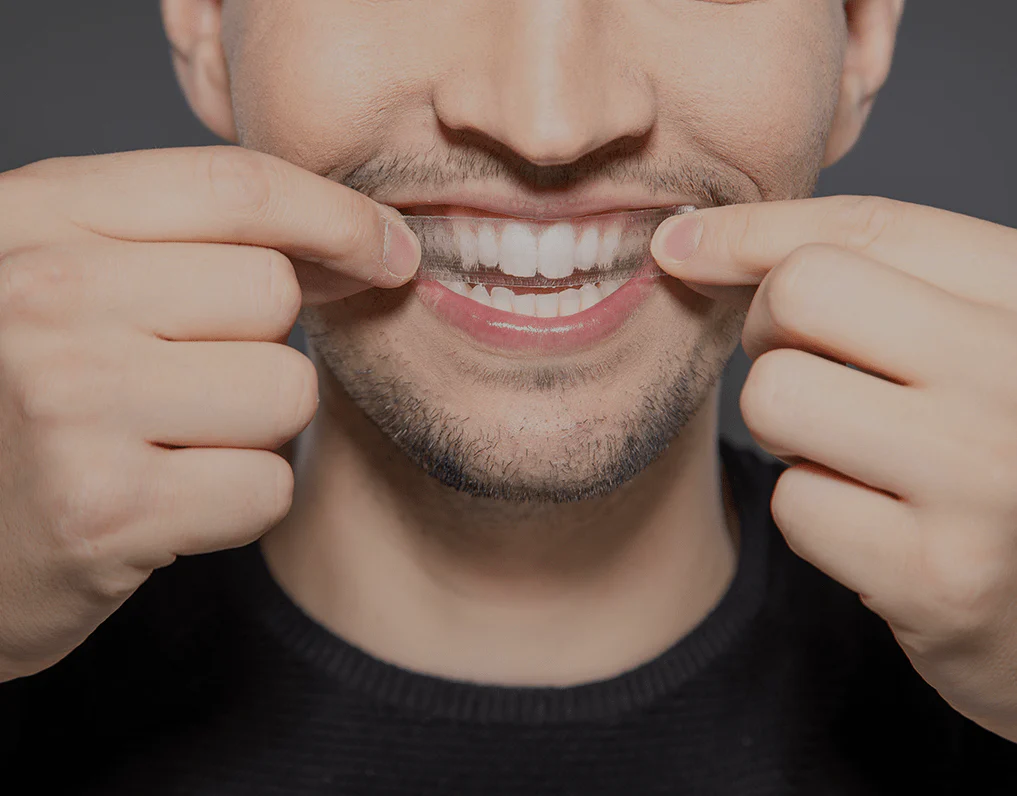 How Are Invisible Aligners Changing Orthodontic Treatments Aylesbury?