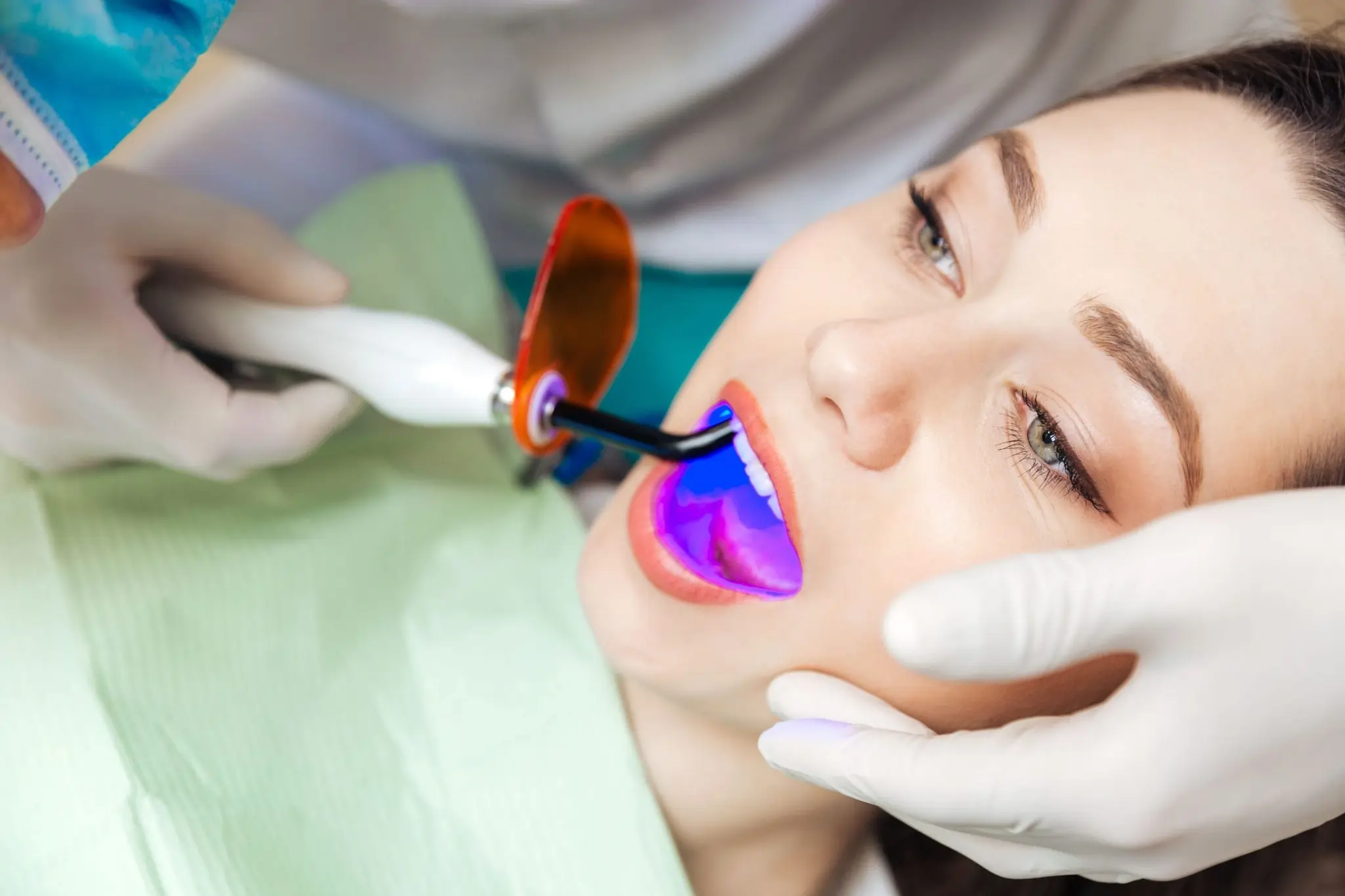 How Long Can You Expect Laser Teeth Whitening Results to Last Aylesbury?