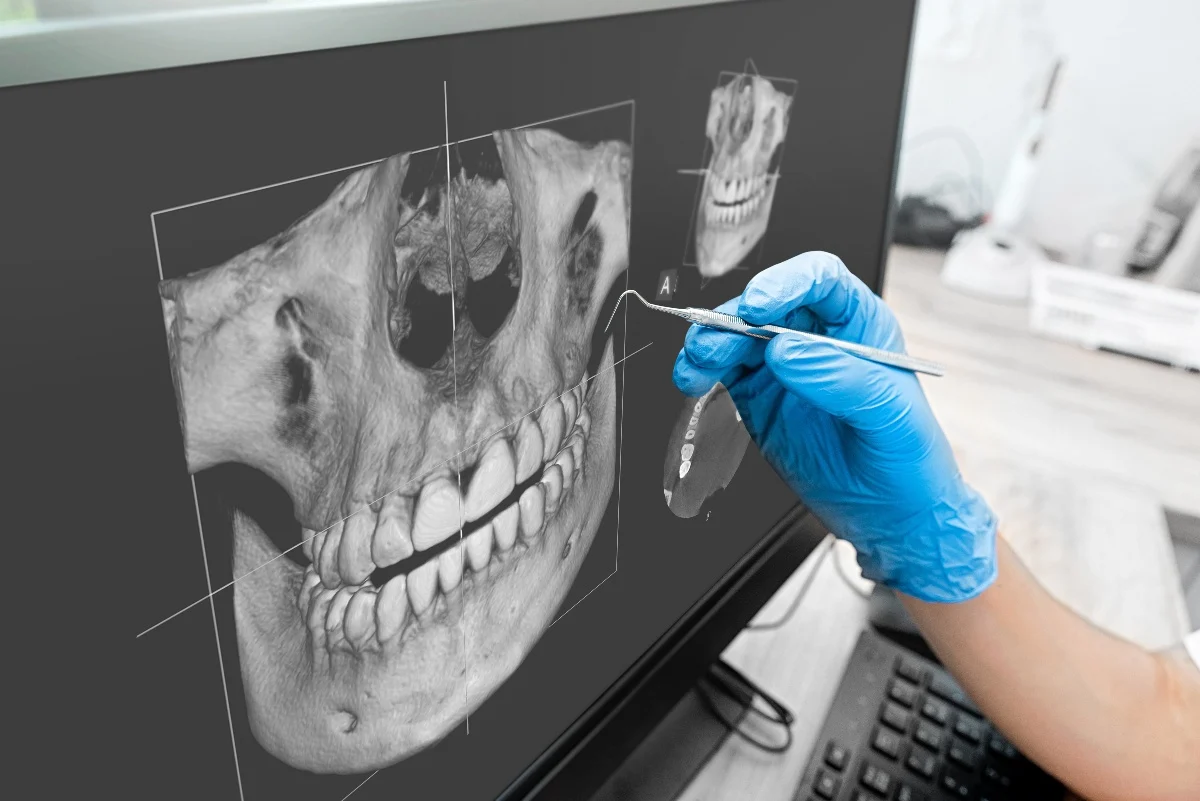 Key Benefits of 3D Printing for Patients and Dentists Aylesbury