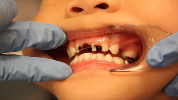 Can Your Diet Help You Achieve a Whiter, Healthier Smile Aylesbury?