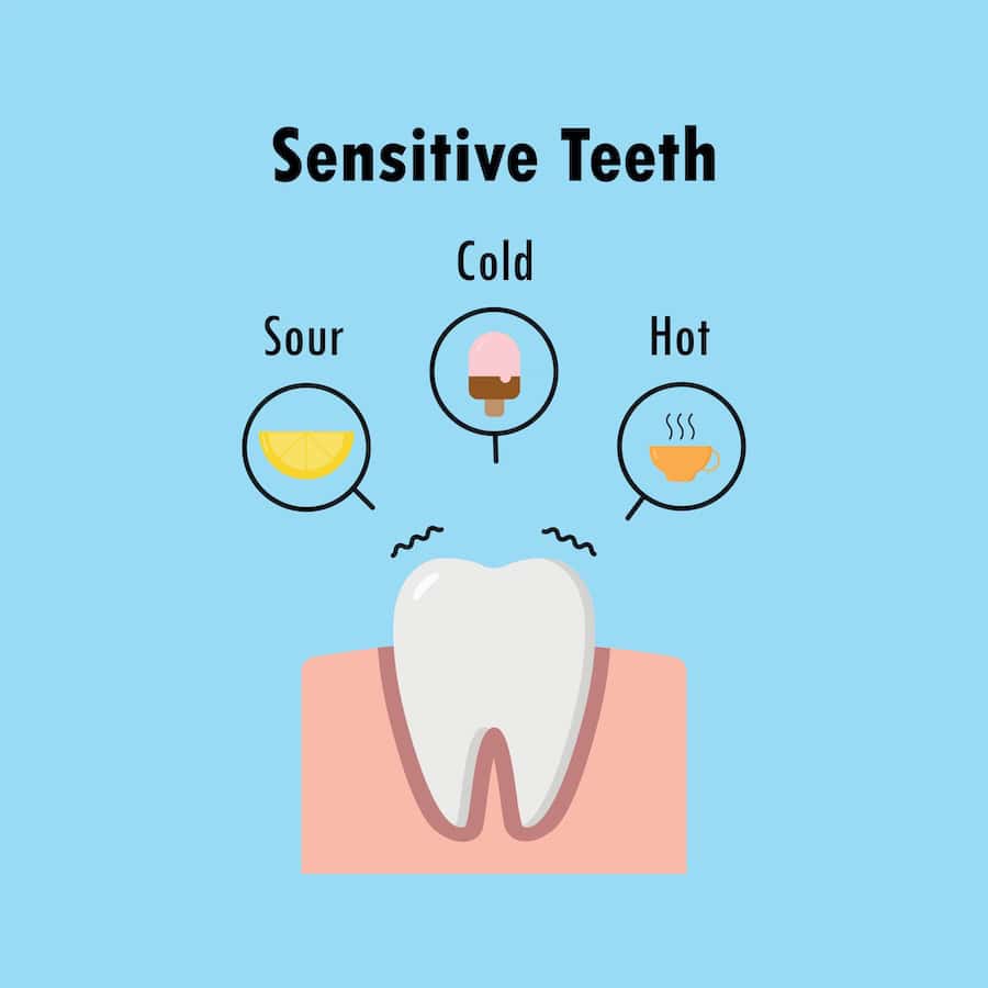 How Can You Tell If Your Teeth Are Becoming Sensitive Aylesbury?