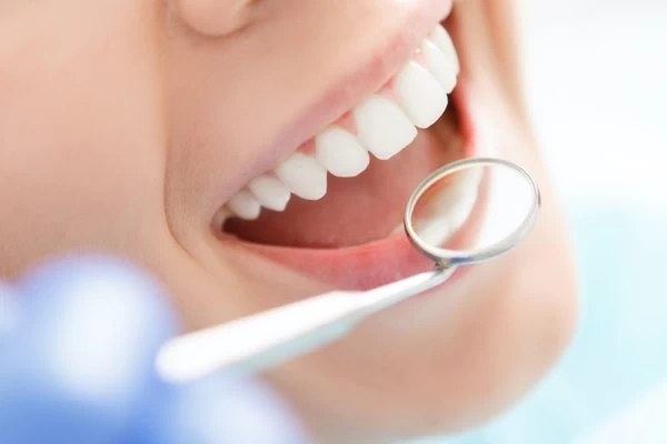 What Are the Best Foods to Eat After Teeth Whitening Aylesbury?