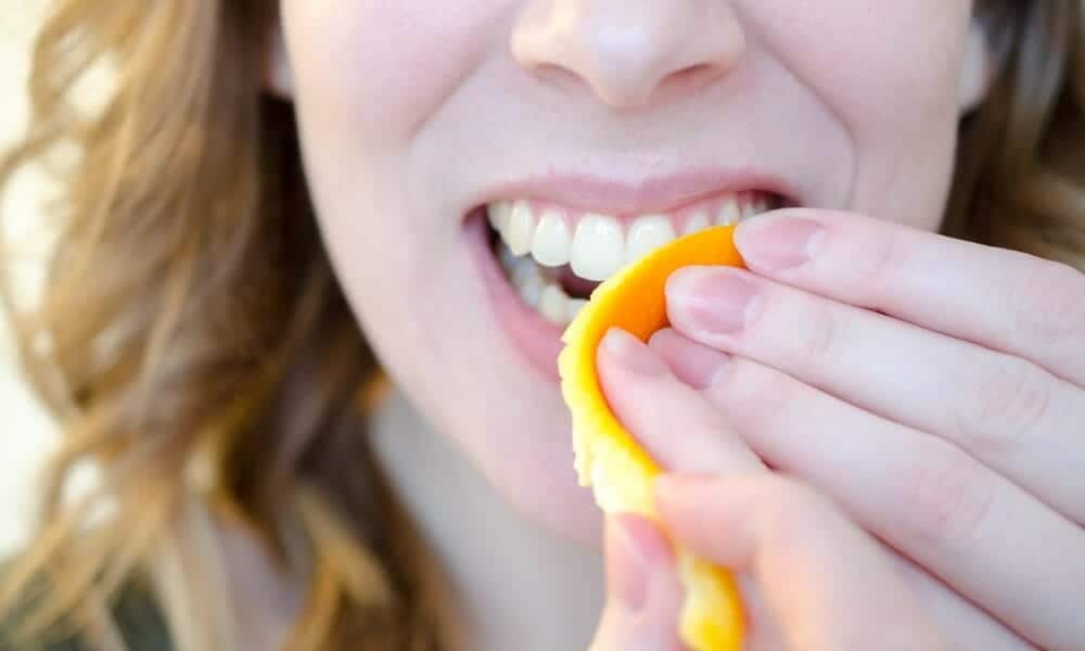 Signs Your Teeth Are Being Damaged by Acid Aylesbury