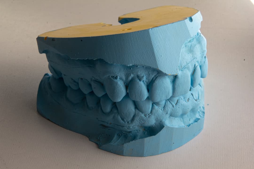 How Do Dental Implants Improve Jawbone Health and Oral Function Aylesbury?