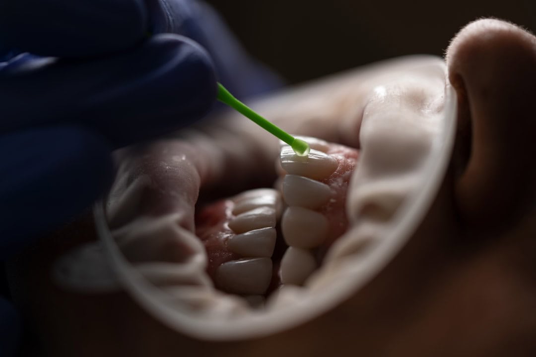 Common Causes of Persistent Dry Mouth Aylesbury