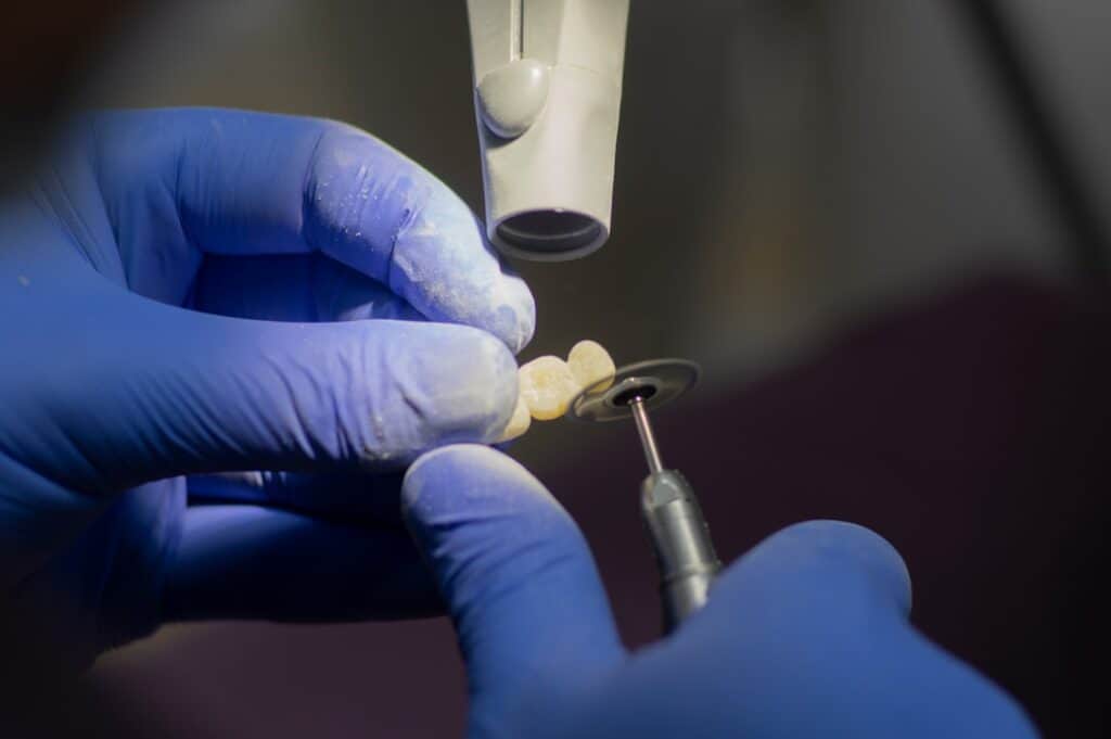 Customised Dental Solutions: Crowns, Aligners, and Implants Aylesbury